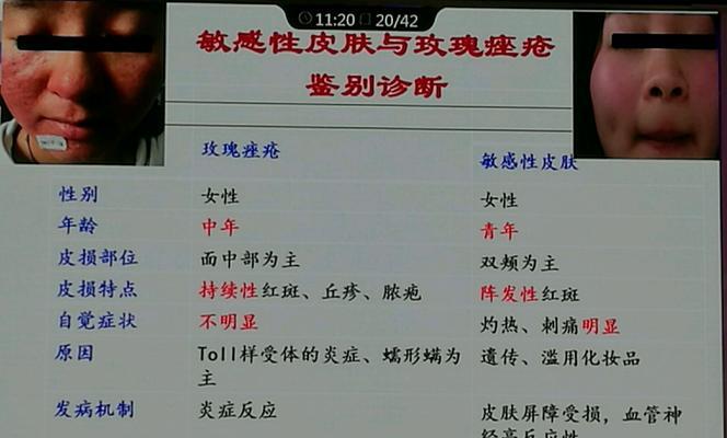 玫瑰的功效与作用医生