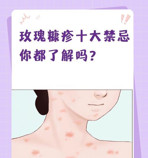 干玫瑰功效与作用及禁忌副作用