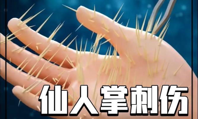 仙人掌刺过长时的养护和保养方法是什么？