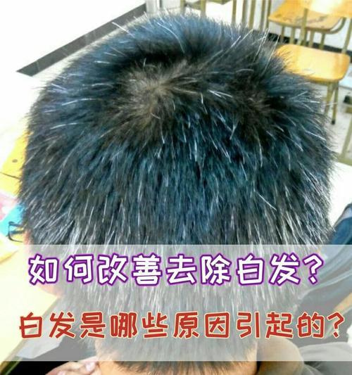 仙人掌发黄软化的原因是什么？如何解决？