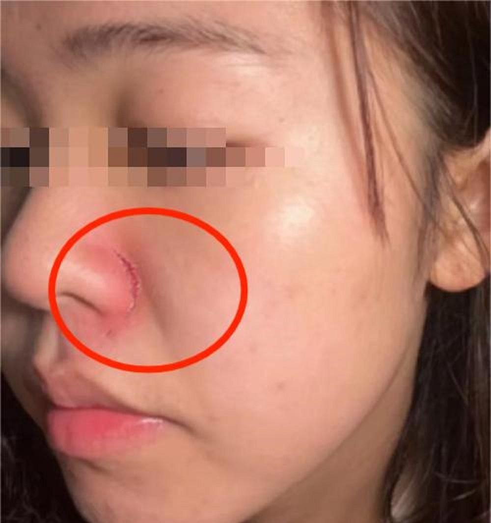 大妈要求让座被拒，出手打伤女乘客，当事人发声，家属拒不道歉