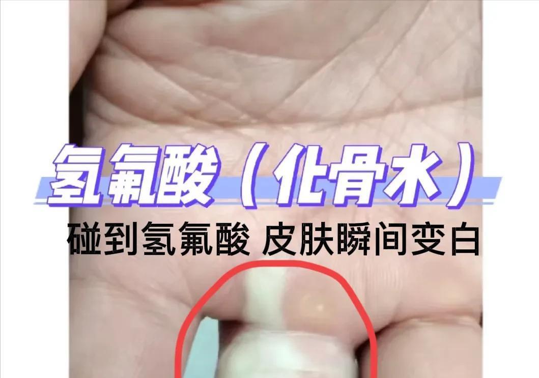 女子踩“化骨水”毒发身亡，相关部门说会兜底，死者女儿曝光细节