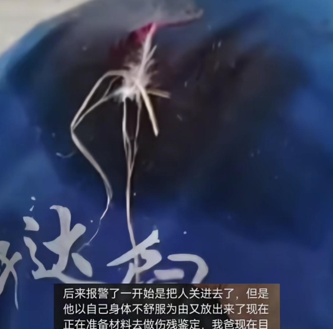 男子家门口被打昏迷！医院下病危，打人者身体不适被放，多方介入